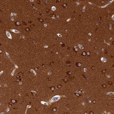 Immunohistochemistry-Paraffin: SRGAP3 Antibody [NBP2-38521]