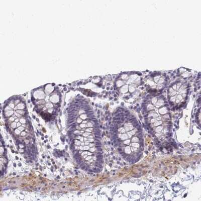 Immunohistochemistry-Paraffin: SRGAP3 Antibody [NBP2-38521]
