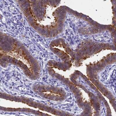 Immunohistochemistry-Paraffin: SRGAP3 Antibody [NBP2-38521]