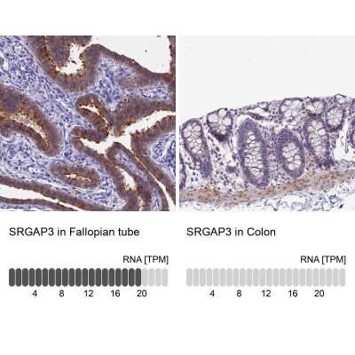 Immunohistochemistry-Paraffin: SRGAP3 Antibody [NBP2-38521]
