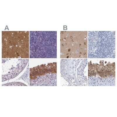 Immunohistochemistry-Paraffin: SRGAP3 Antibody [NBP2-38521]