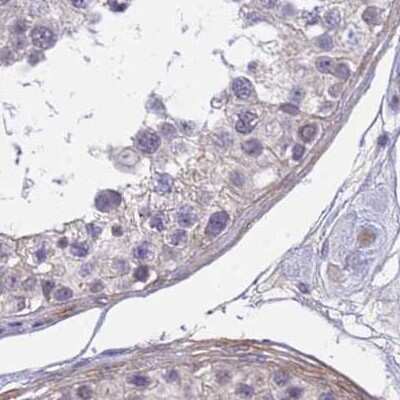 Immunohistochemistry-Paraffin: SRGAP3 Antibody [NBP2-38521]