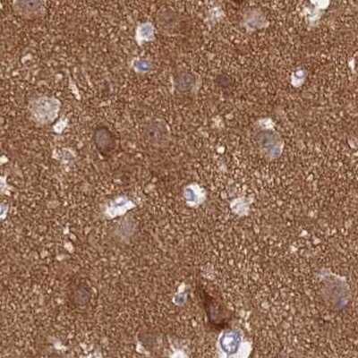 Immunohistochemistry-Paraffin: SRGAP3 Antibody [NBP2-38521]