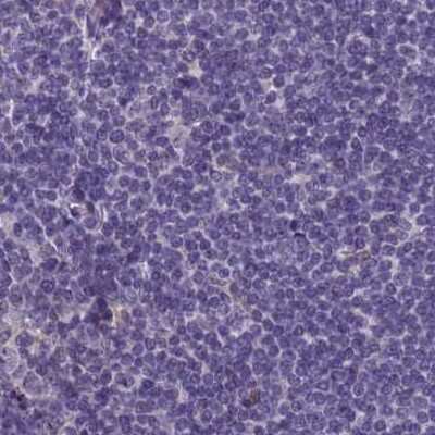Immunohistochemistry-Paraffin: SRGAP3 Antibody [NBP2-38521]