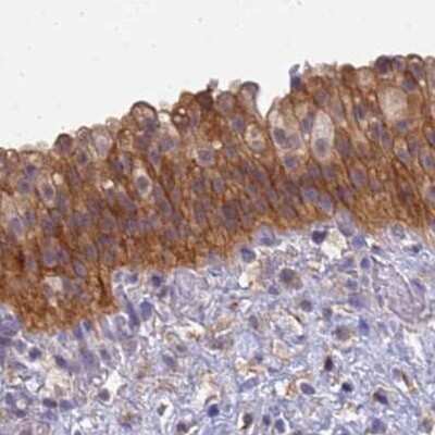 Immunohistochemistry-Paraffin: SRGAP3 Antibody [NBP2-38521]