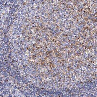 Immunohistochemistry-Paraffin: SRGN Antibody [NBP1-80886]