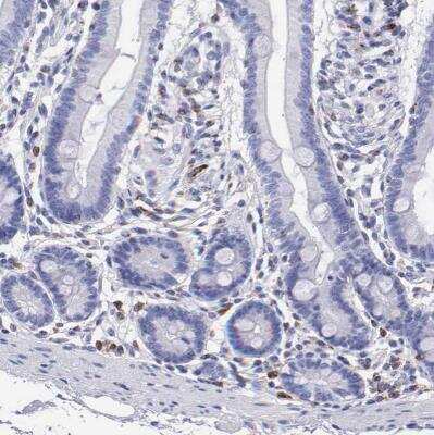 Immunohistochemistry-Paraffin: SRGN Antibody [NBP1-80886]