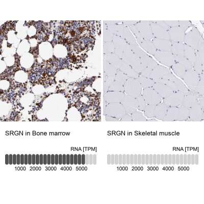 Immunohistochemistry-Paraffin: SRGN Antibody [NBP1-80886]