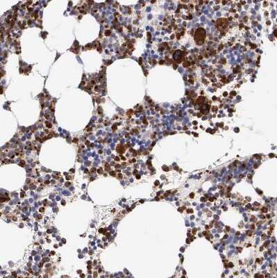 Immunohistochemistry-Paraffin: SRGN Antibody [NBP1-80886]
