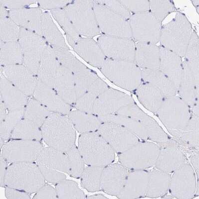Immunohistochemistry-Paraffin: SRGN Antibody [NBP1-80886]