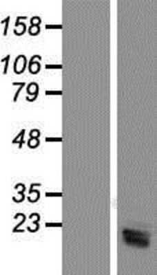 Western Blot: SRGN Overexpression Lysate [NBP2-08075]