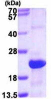 SDS-PAGE: Recombinant Human SRGN His Protein [NBP1-72483]