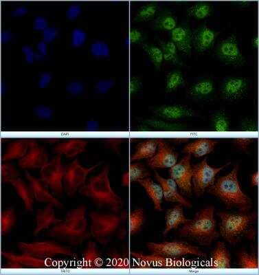 Immunocytochemistry/ Immunofluorescence: SRI Antibody - BSA Free [NBP2-24479]