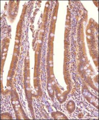 Immunohistochemistry-Paraffin: SRI Antibody - BSA Free [NBP2-24479]