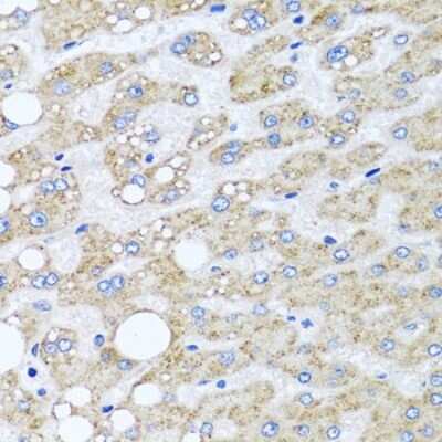 Immunohistochemistry-Paraffin: SRI Antibody - BSA Free [NBP2-94910]