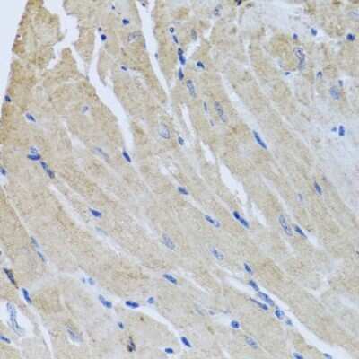 Immunohistochemistry-Paraffin: SRI Antibody - BSA Free [NBP2-94910]