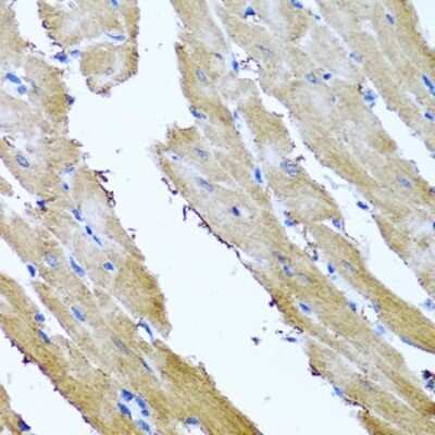 Immunohistochemistry-Paraffin: SRI Antibody - BSA Free [NBP2-94910]