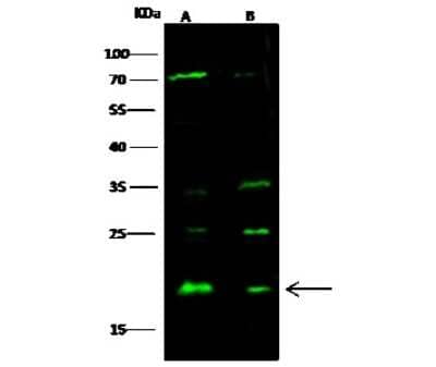 Western Blot: SRI Antibody [NBP3-00310]