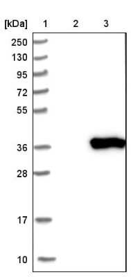 Western Blot: SRM Antibody [NBP1-80726]