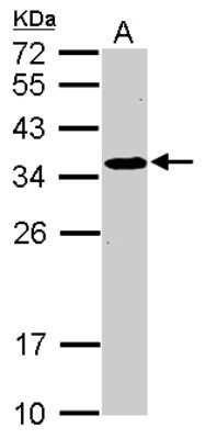 Western Blot: SRM Antibody [NBP2-20482]