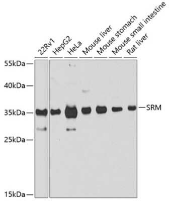 Western Blot: SRM AntibodyBSA Free [NBP2-93851]