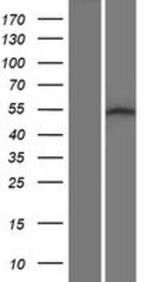 Western Blot: SRMS Overexpression Lysate [NBP2-05756]