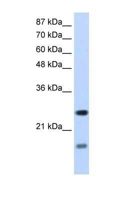 Western Blot: SRP14 Antibody [NBP1-57413]