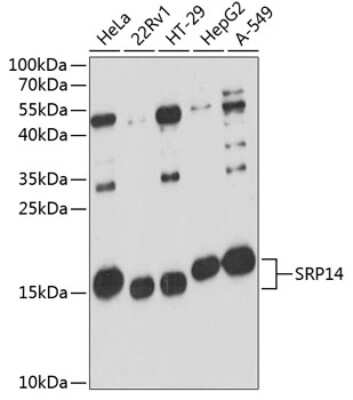 Western Blot: SRP14 AntibodyAzide and BSA Free [NBP2-94184]