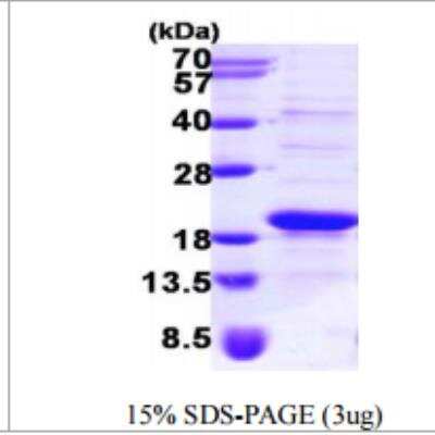 SDS-PAGE: Recombinant Human SRP14 His Protein [NBP1-50885]