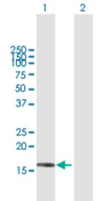 Western Blot: SRP19 Antibody [H00006728-B01P]