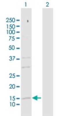 Western Blot: SRP19 Antibody [H00006728-D01P]