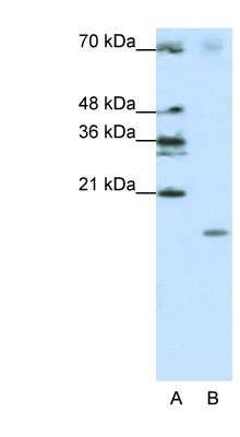 Western Blot: SRP19 Antibody [NBP1-57425]