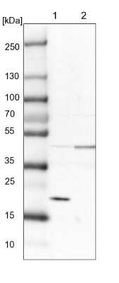 Western Blot: SRP19 Antibody [NBP1-89507]