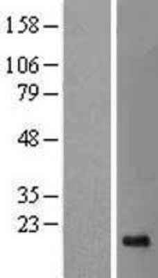 Western Blot: SRP19 Overexpression Lysate [NBL1-16453]