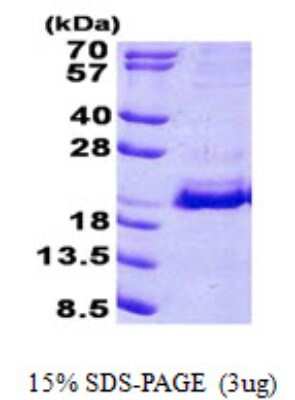 SDS-PAGE: Recombinant Human SRP19 His Protein [NBP2-23473]