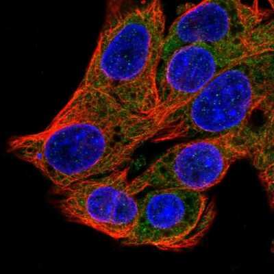 Immunocytochemistry/ Immunofluorescence: SRP54 Antibody [NBP2-56255]