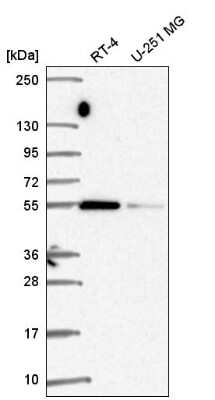 Western Blot: SRP54 Antibody [NBP2-56255]