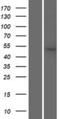 Western Blot: SRP54 Overexpression Lysate [NBP2-10150]