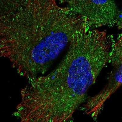 Immunocytochemistry/ Immunofluorescence: SRP68 Antibody [NBP2-55721]