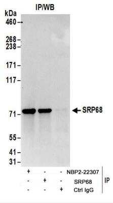 Immunoprecipitation: SRP68 Antibody [NBP2-22307]