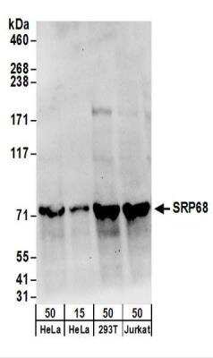 Western Blot: SRP68 Antibody [NBP2-22307]
