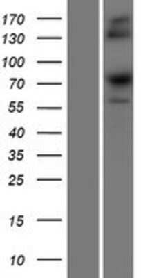 Western Blot: SRP68 Overexpression Lysate [NBP2-07369]