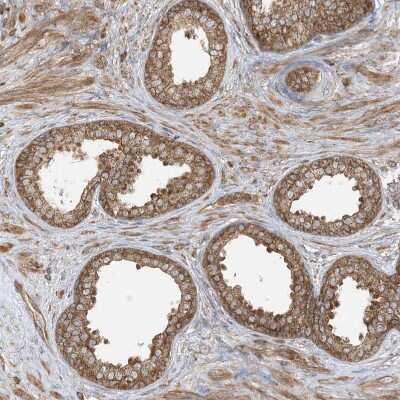 Immunohistochemistry-Paraffin: SRP72 Antibody [NBP1-89498]