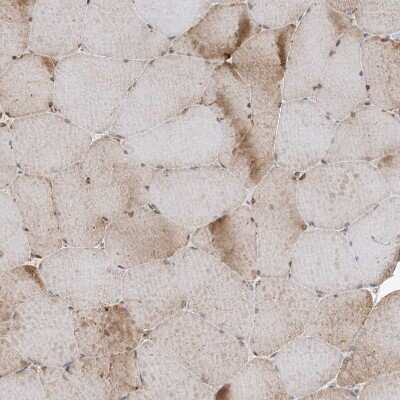 Immunohistochemistry-Paraffin: SRP72 Antibody [NBP1-89498]