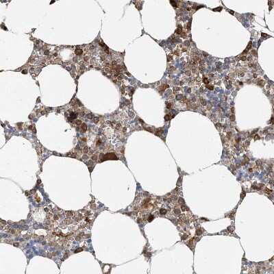Immunohistochemistry-Paraffin: SRP72 Antibody [NBP1-89498]