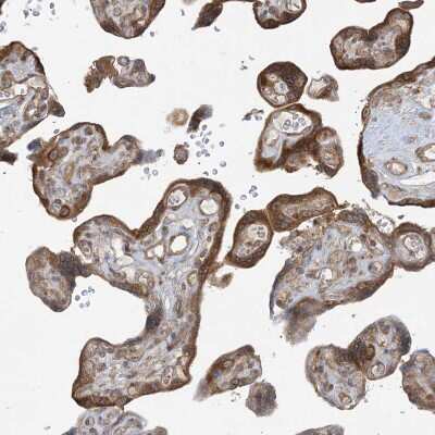 Immunohistochemistry-Paraffin: SRP72 Antibody [NBP1-89498]