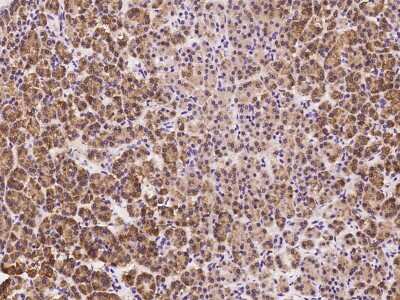 Immunohistochemistry-Paraffin: SRP72 Antibody [NBP2-97754]