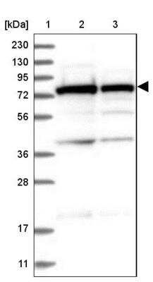 Western Blot: SRP72 Antibody [NBP1-89498]