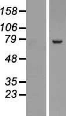 Western Blot: SRP72 Overexpression Lysate [NBP2-07552]