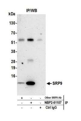 Immunoprecipitation: SRP9 Antibody [NBP2-61107]